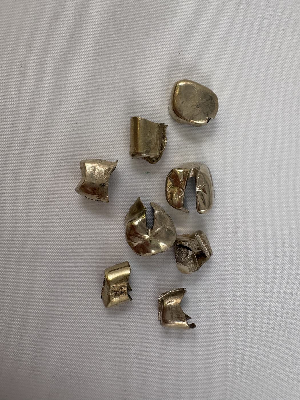 Zahngold, Zahnkronen und Dentallegierungen zum Zahngold-Ankauf in Kempen